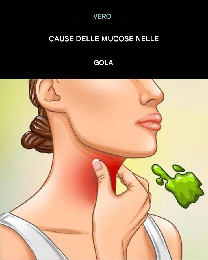 Le vere cause del muco in gola e come eliminarlo