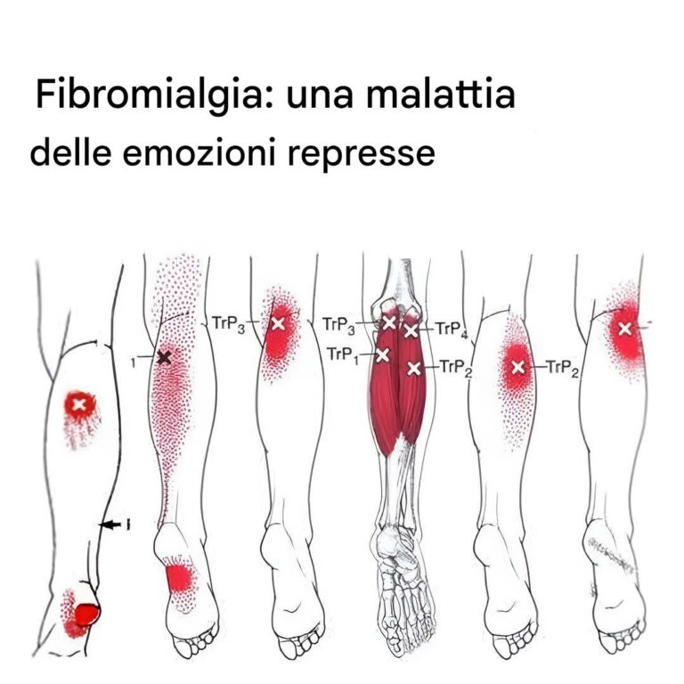 Fibromialgia: Cosa Devi Sapere se Ti Senti Sempre Stanco e Hai Dolori Incontrollabili