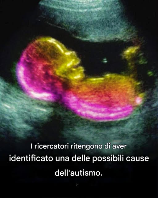 Uno studio evidenzia una possibile correlazione con lo sviluppo dell’autismo.