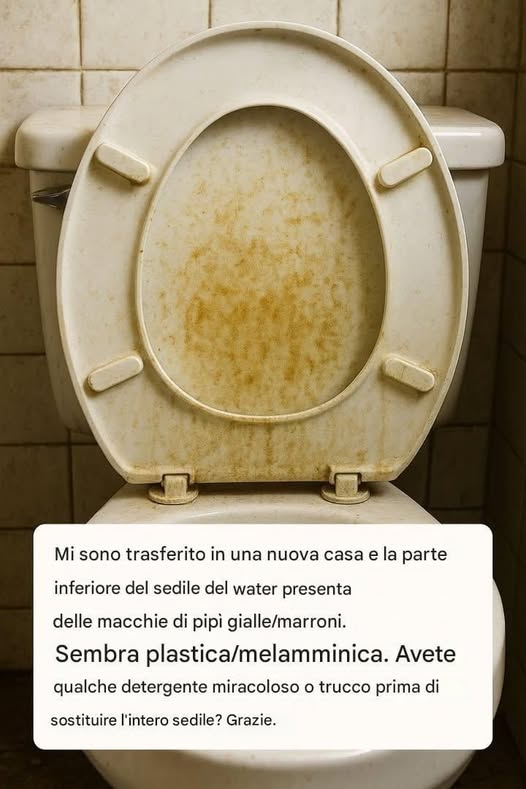 Sedile del WC con macchie giallo-marroni: perché si formano e come eliminarle