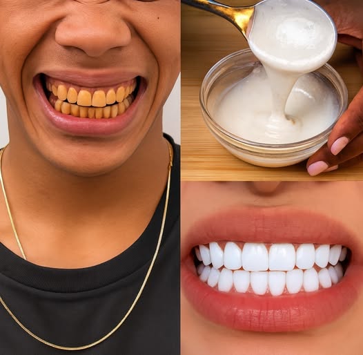 Come ottenere denti più bianchi con questo metodo naturale.