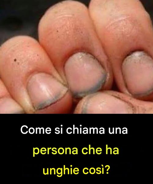 Come si chiama una persona che ha unghie così?
