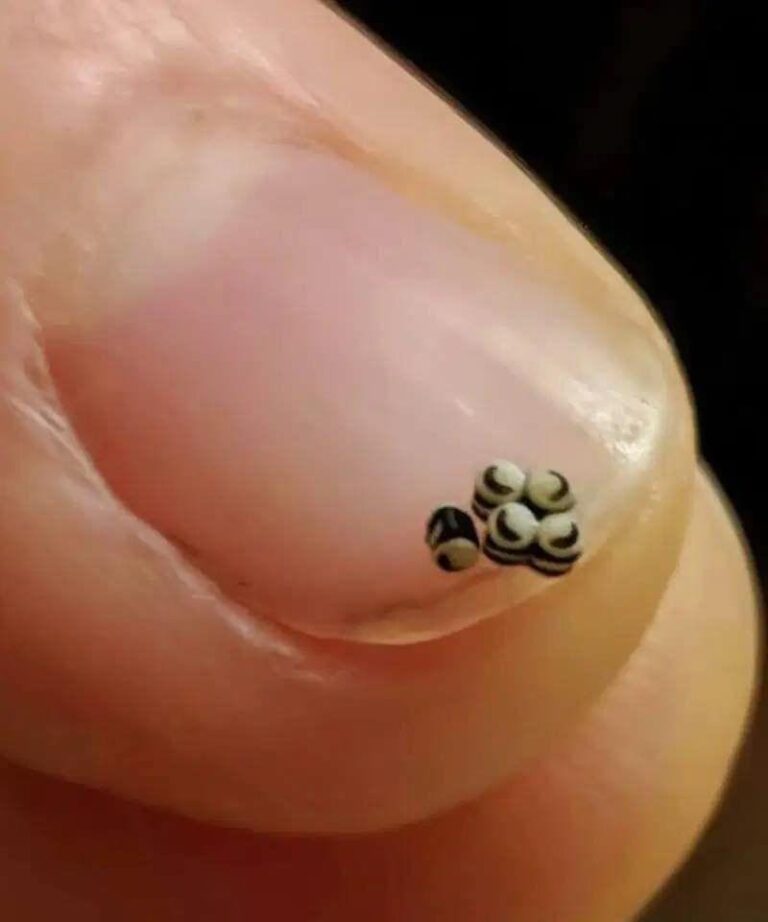 Abbiamo ordinato un’insalata, ma c’erano delle piccole macchie nere nel cibo: siamo andati direttamente in ospedale