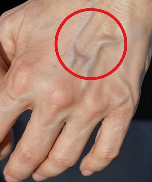 Se hai vene visibili, significa che sei…